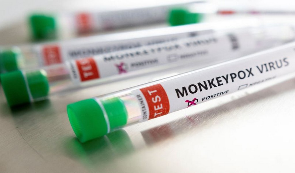 Portugal informa de 14 nuevos casos confirmados de viruela del mono, con un total de 37